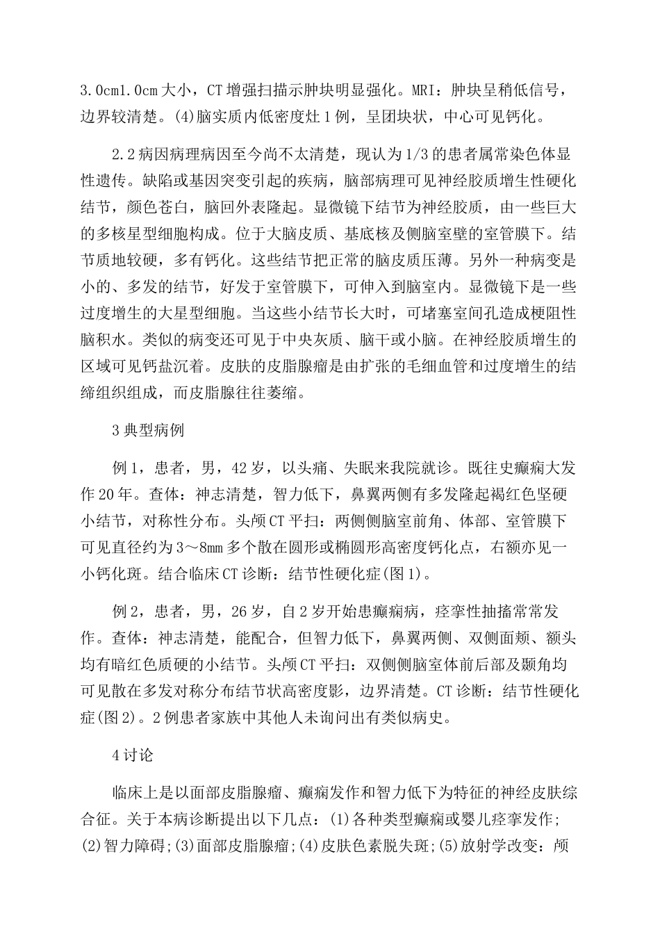 什么是结节性硬化的影像诊断_第2页