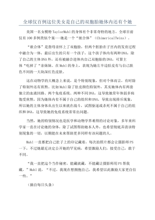 全球仅百例这位美女是自己的双胞胎她体内还有个她