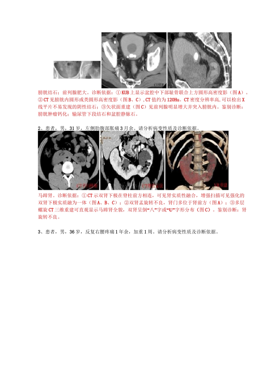 大学影像学精品课程试题(泌尿系统)_第3页