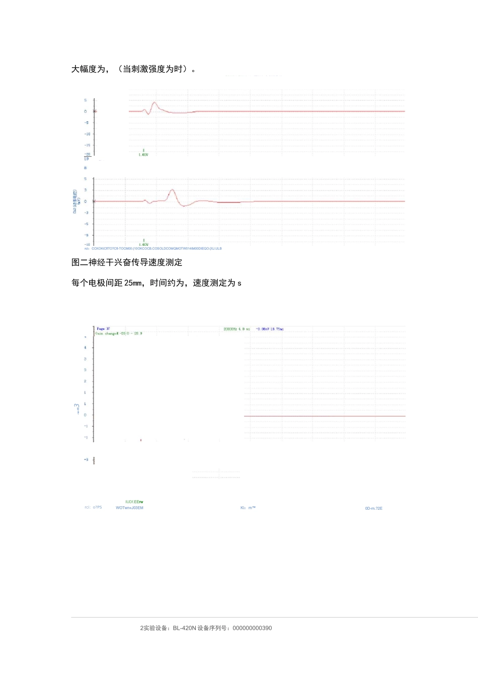 神经干动作电位、兴奋传导速度和不应期测定实验报告_第2页