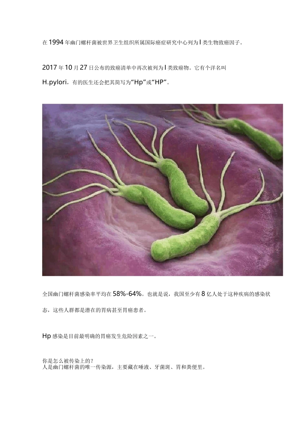 疯狂的HP幽门螺旋杆菌科普_第2页