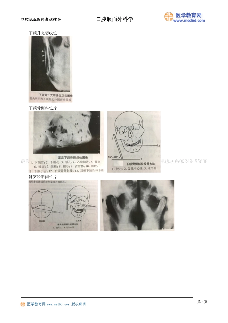 执业医师-口腔颌面部影像学诊断_第3页