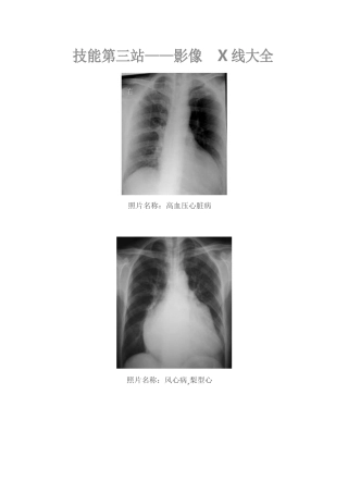 执业医师-内部学员面授资料—影像X线大全
