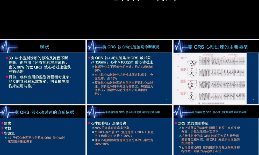 XXXX年宽QRS波心动过速鉴别诊断新流程
