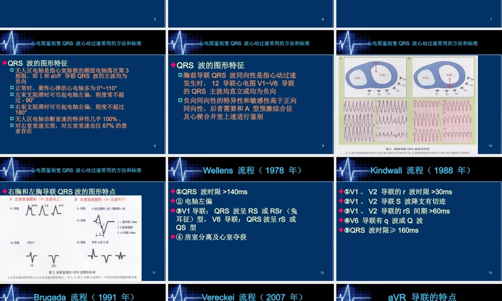 XXXX年宽QRS波心动过速鉴别诊断新流程