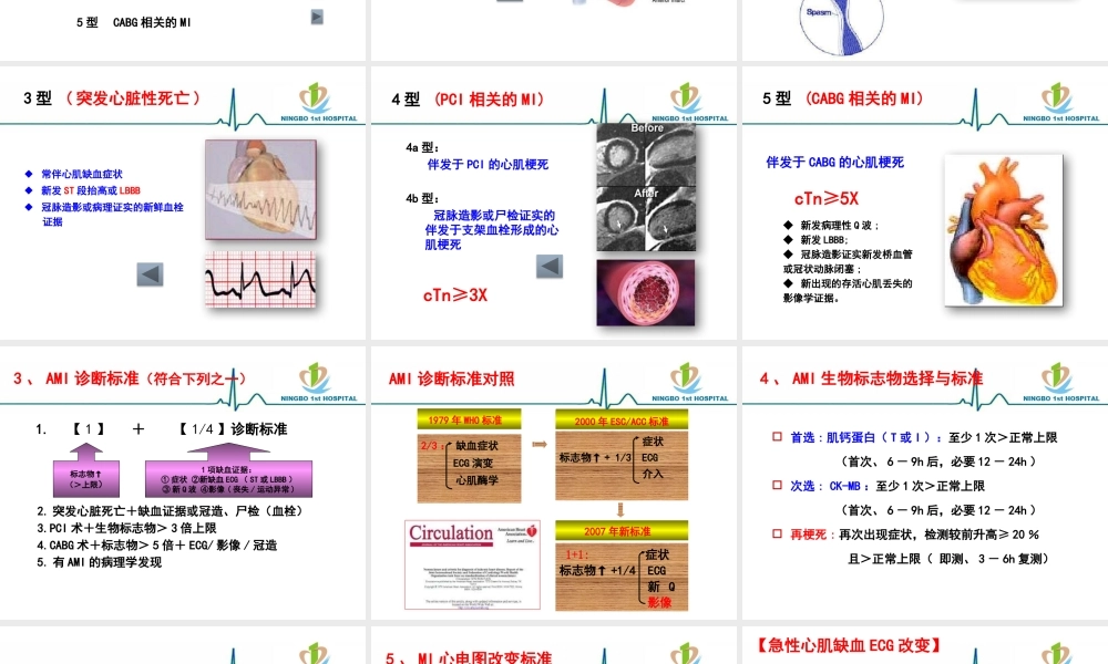 XXXX年心肌梗死再定义和心电图诊断新理念