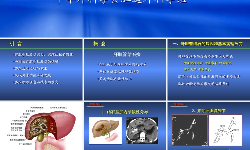 XXXX诊断治疗指南(肝胆管结石)