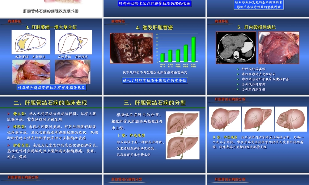 XXXX诊断治疗指南(肝胆管结石)