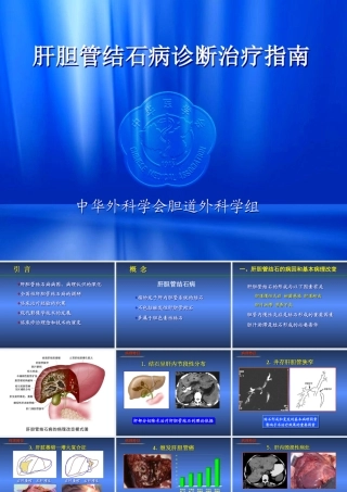 XXXX诊断治疗指南(肝胆管结石)