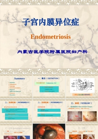 妊娠高血压综合征的诊断和治疗