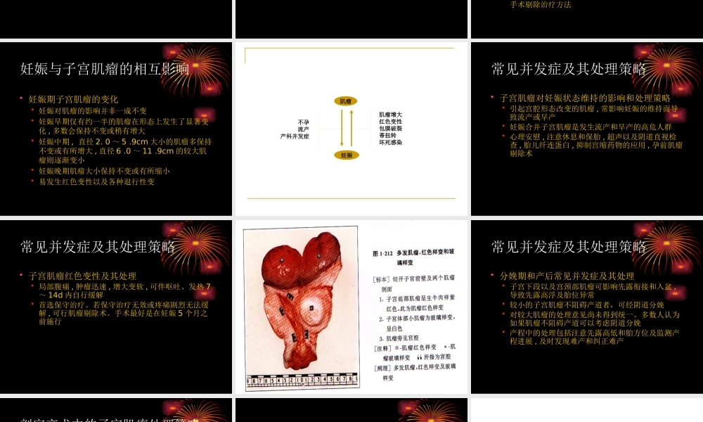 妊娠合并子宫肌瘤的诊断与处理