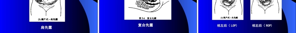 妊娠诊断-第一章女性生殖系统解剖