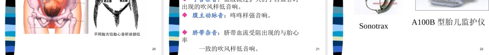 妊娠诊断基础知识讲义