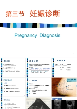 妊娠诊断基础知识讲义