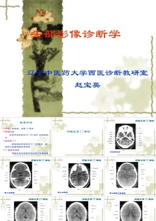 头部CT诊断学