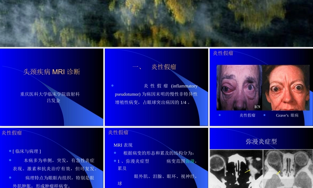 头颈部MRI诊断吕