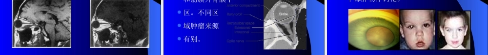 头颈部MRI诊断吕