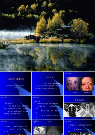 头颈部MRI诊断吕