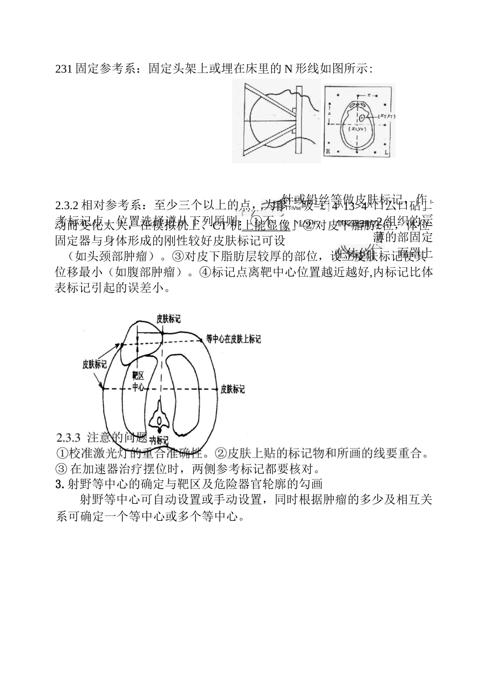 三维适形放射治疗过程流程_第2页