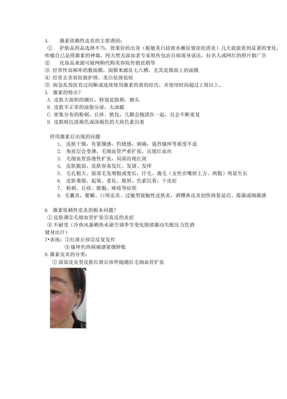 激素依赖性皮炎_第2页