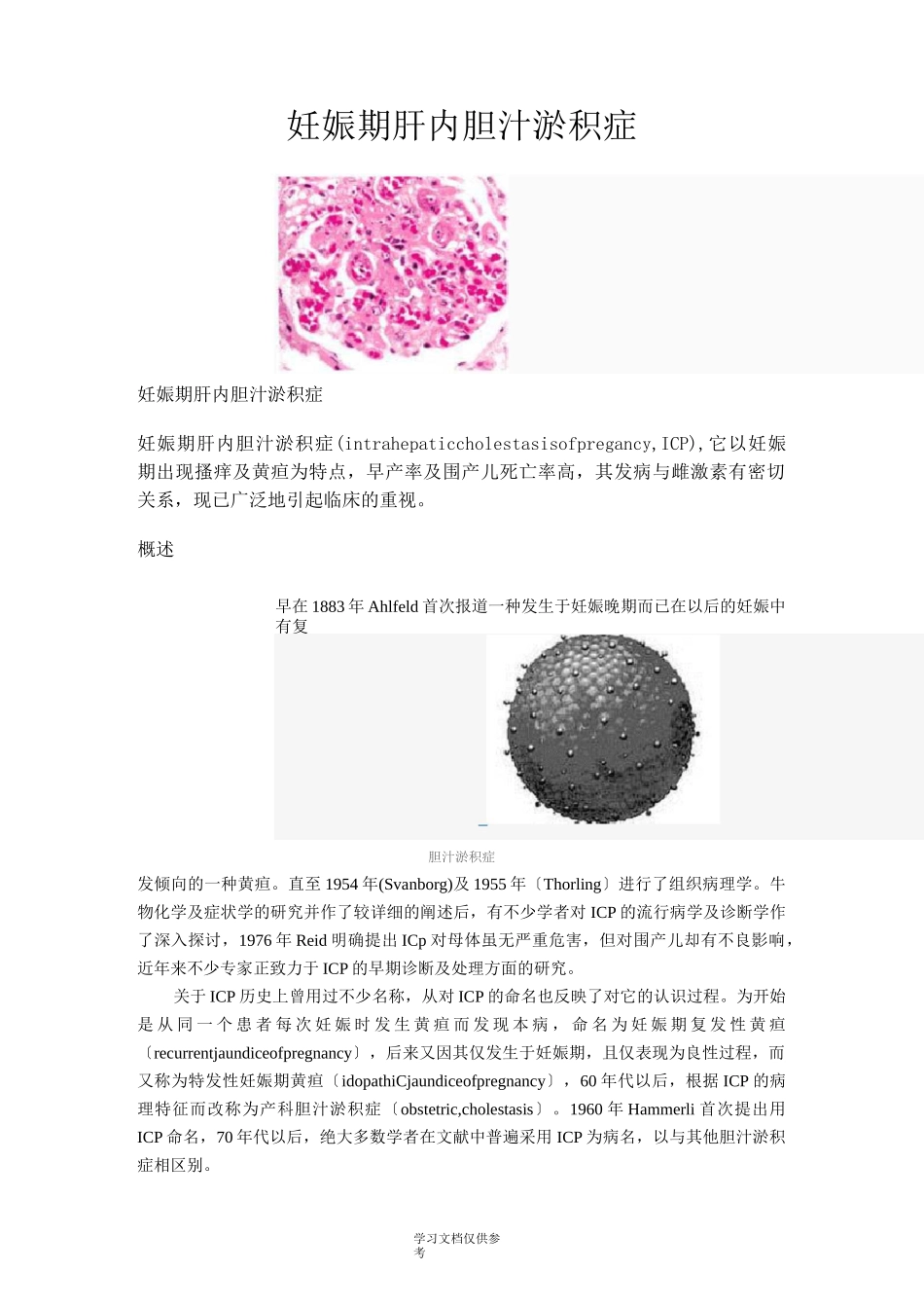 妊娠期肝内胆汁淤积症_第1页