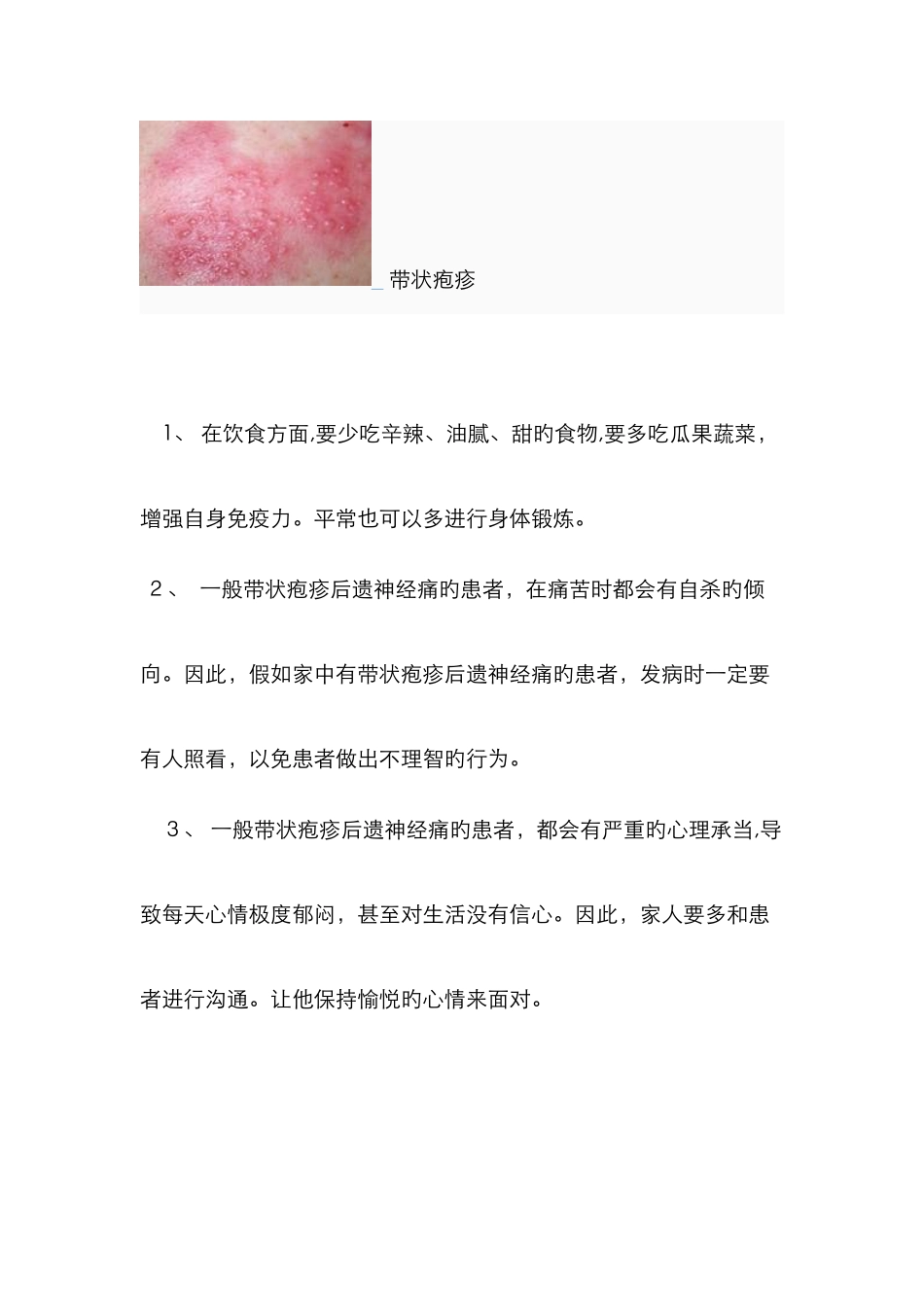 带状疱疹神经痛出院指导_第2页