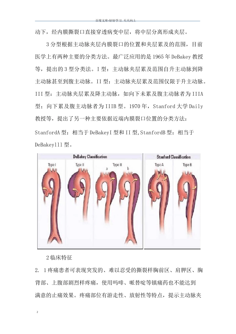 妊娠合并主动脉夹层_第2页