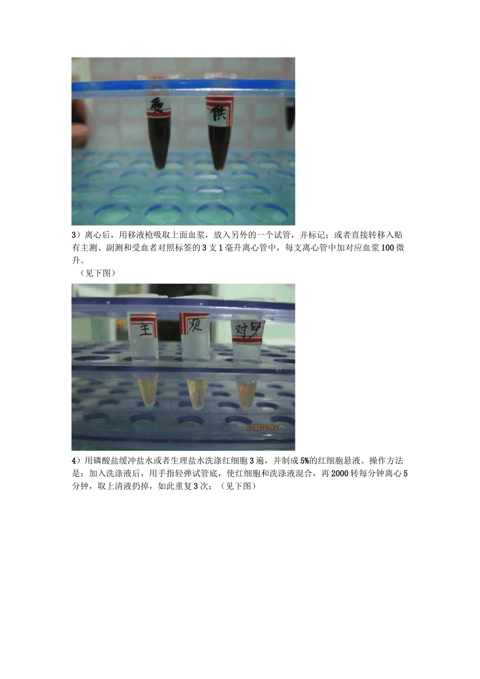 犬猫血液 输血的知识_第2页