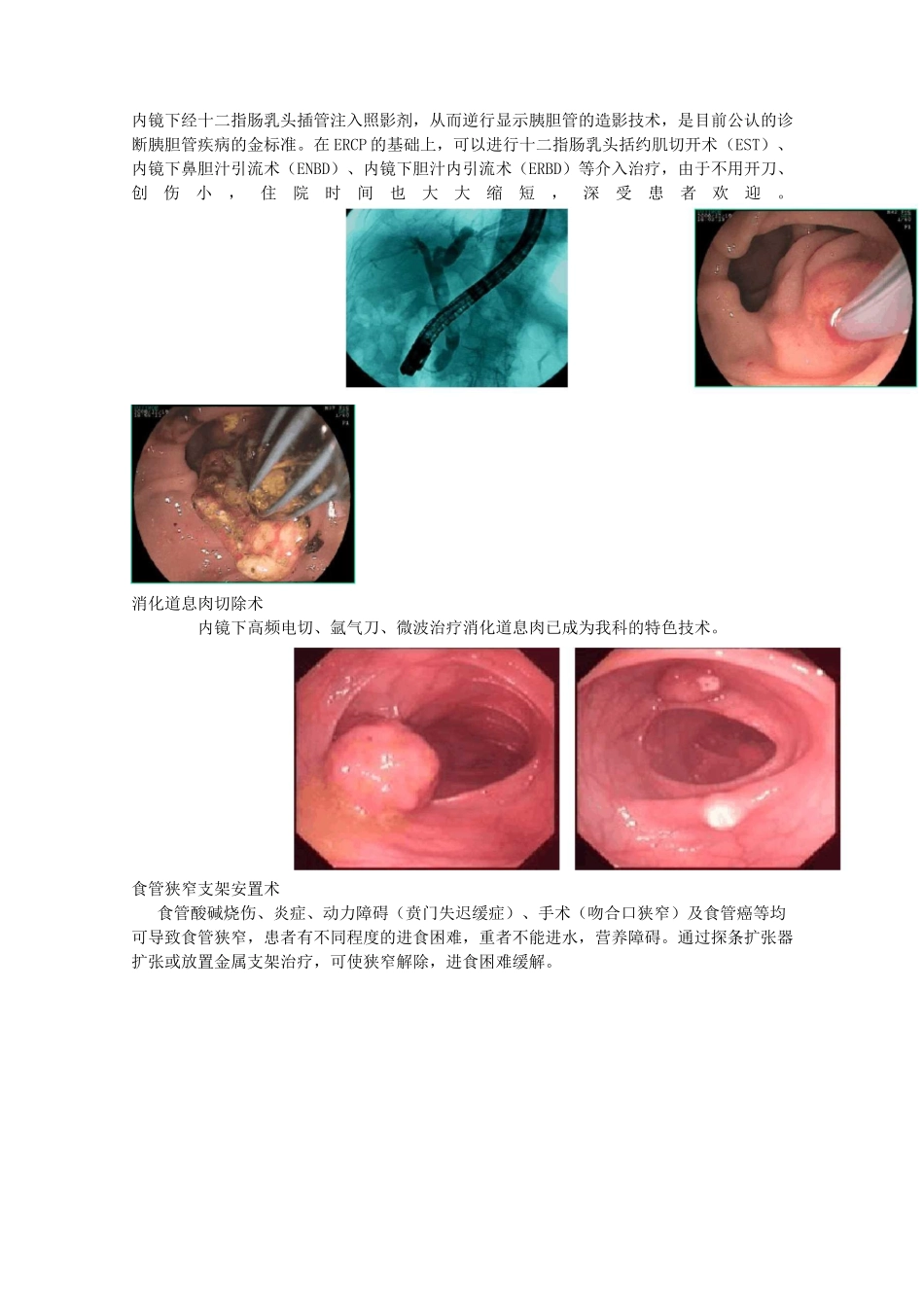 消化内科科室简介与常见病健康宣教_第2页