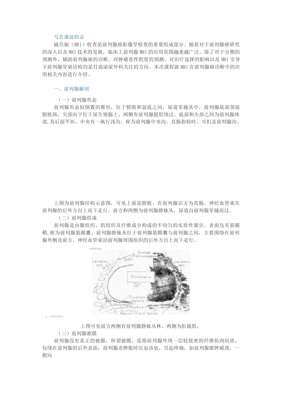 前列腺MRI_第1页