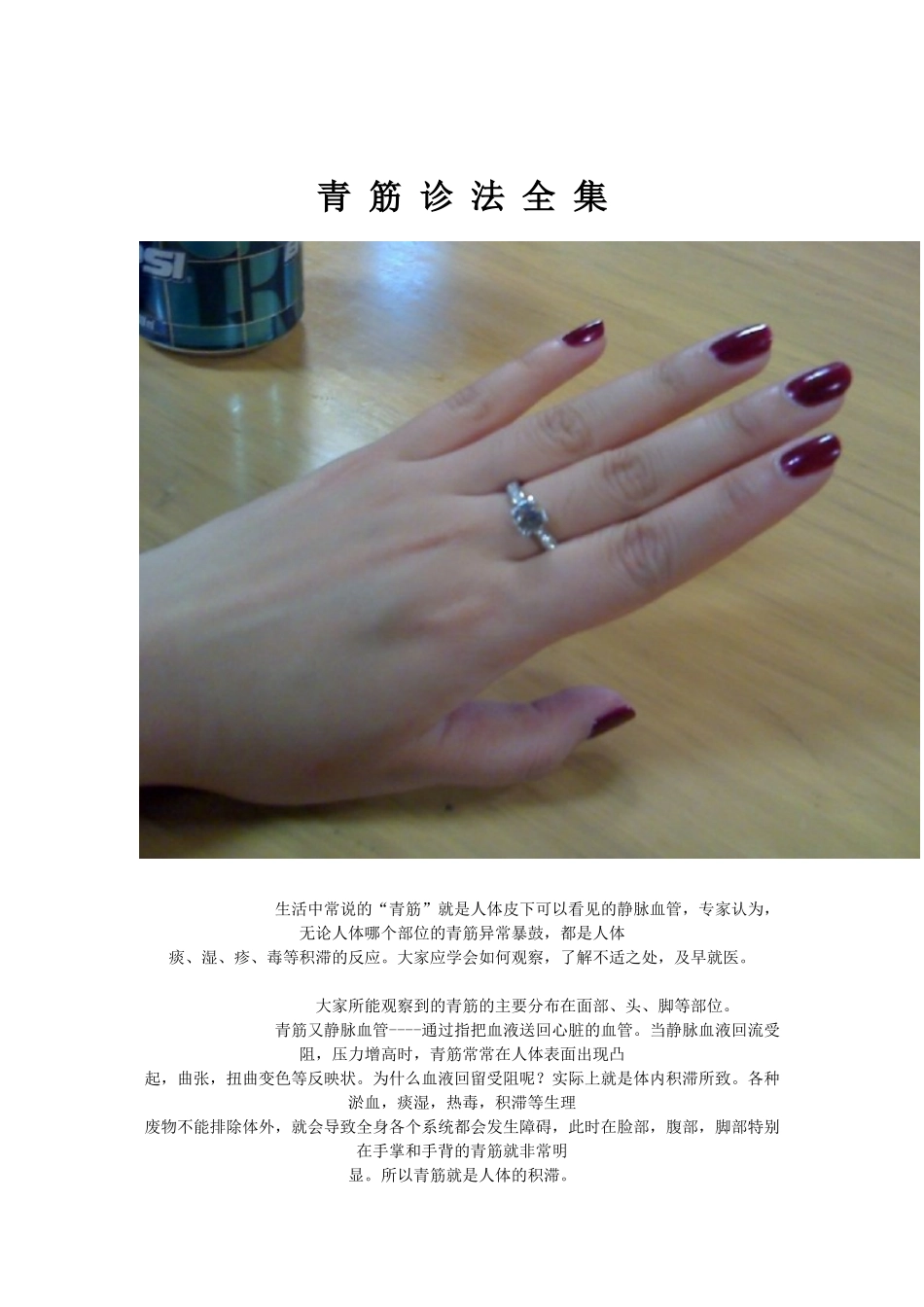 青筋诊断方法_第1页