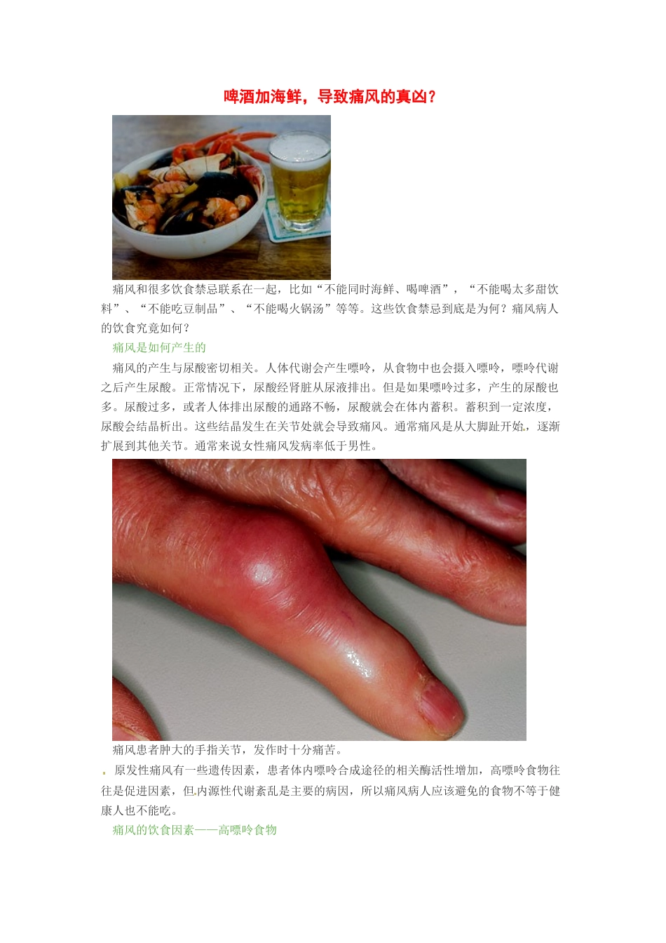 2014年高考化学二轮复习（热门素材+练习）啤酒加海鲜，导致痛风的真凶？_第1页