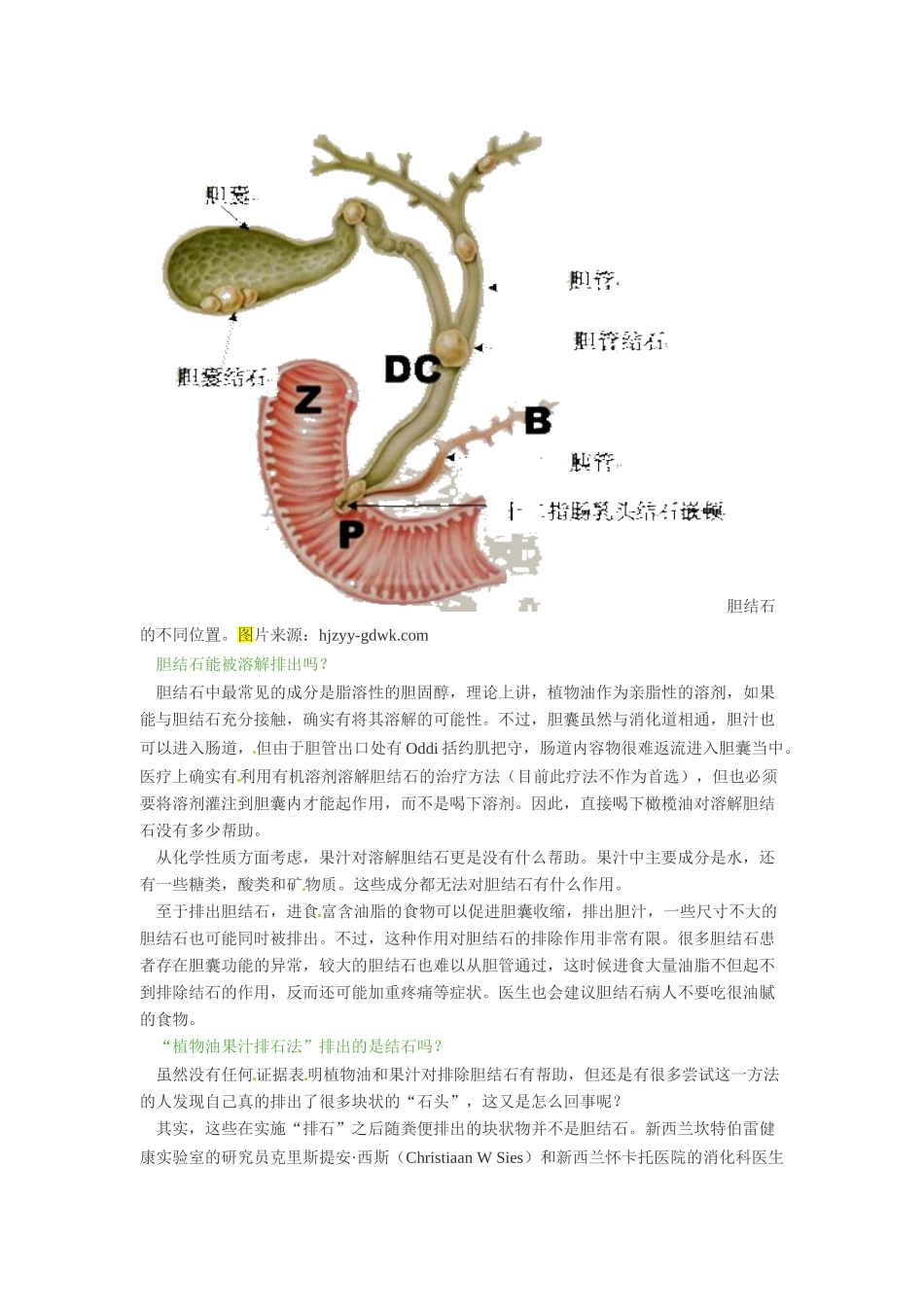 2014年高考化学二轮复习（热门素材+练习）喝果汁和植物油能排出胆结石吗？_第2页