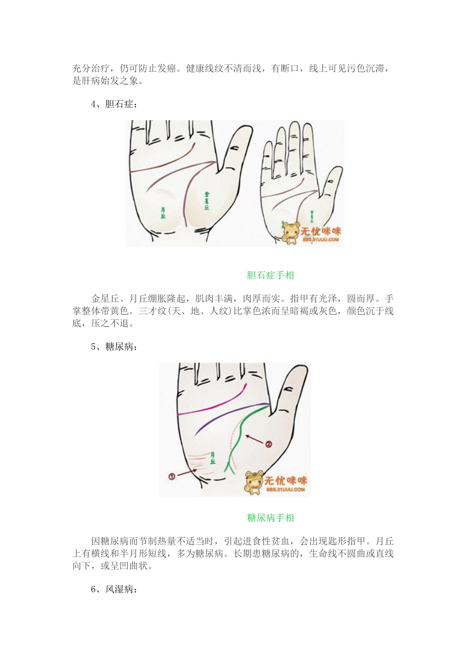 2024年医学专题—做自己的医生24种手相揭示身心健康问题_第3页