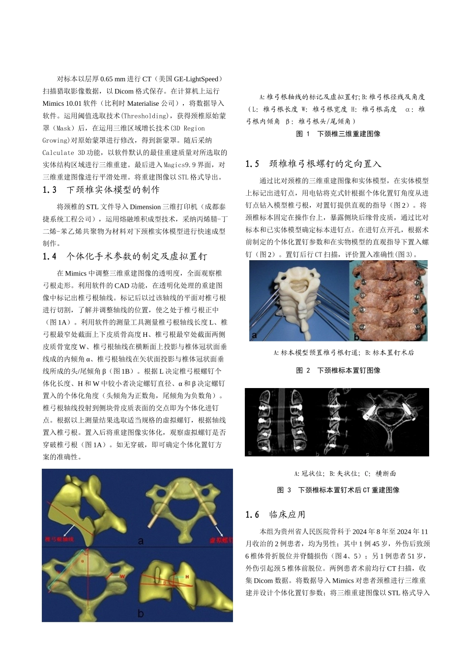Mimics及脊柱模型用于下颈椎椎弓根个体化置钉的应用研究_第3页