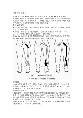 下肢深静脉血栓DVT