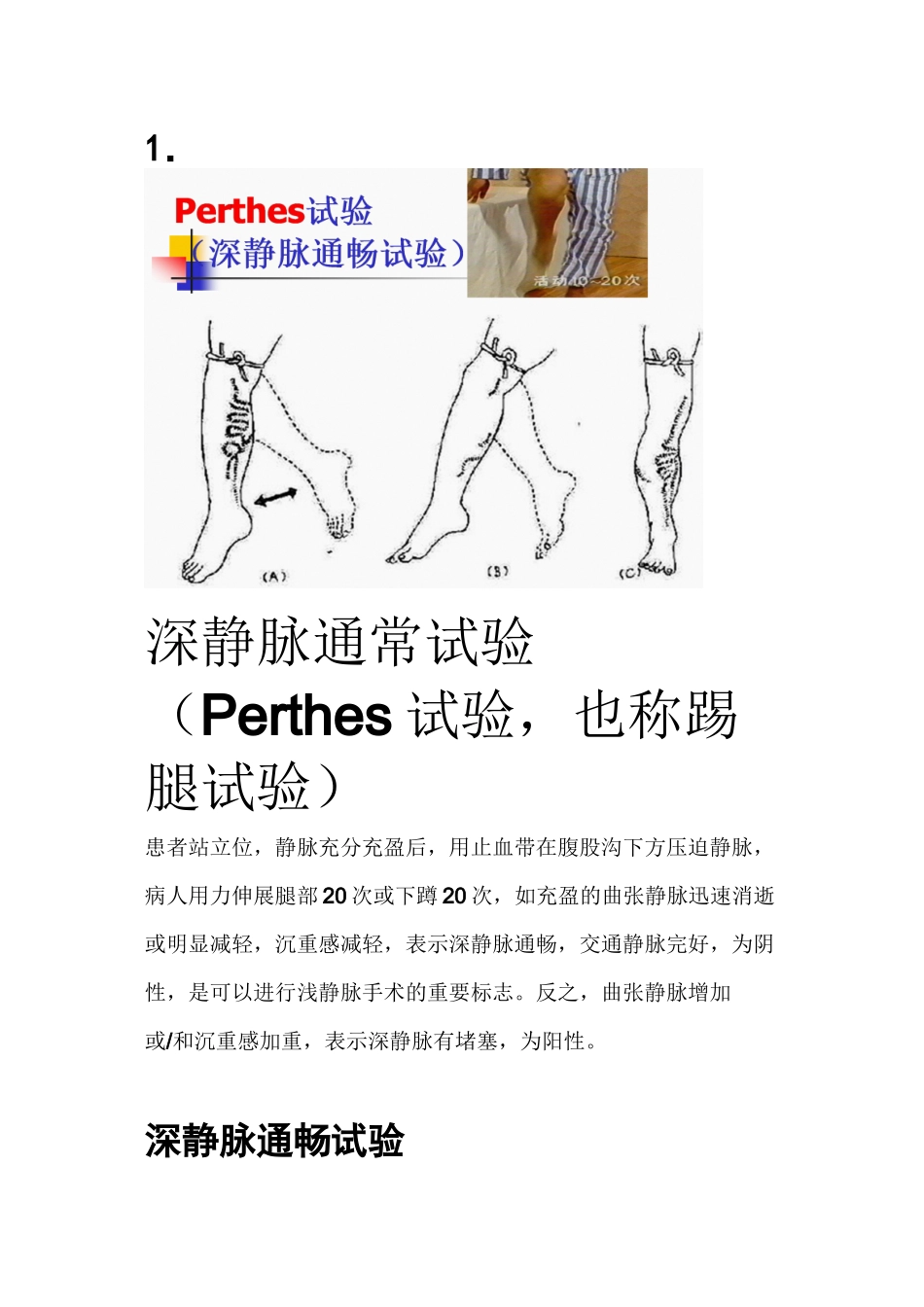 下肢静脉曲张三种检查方法_第1页