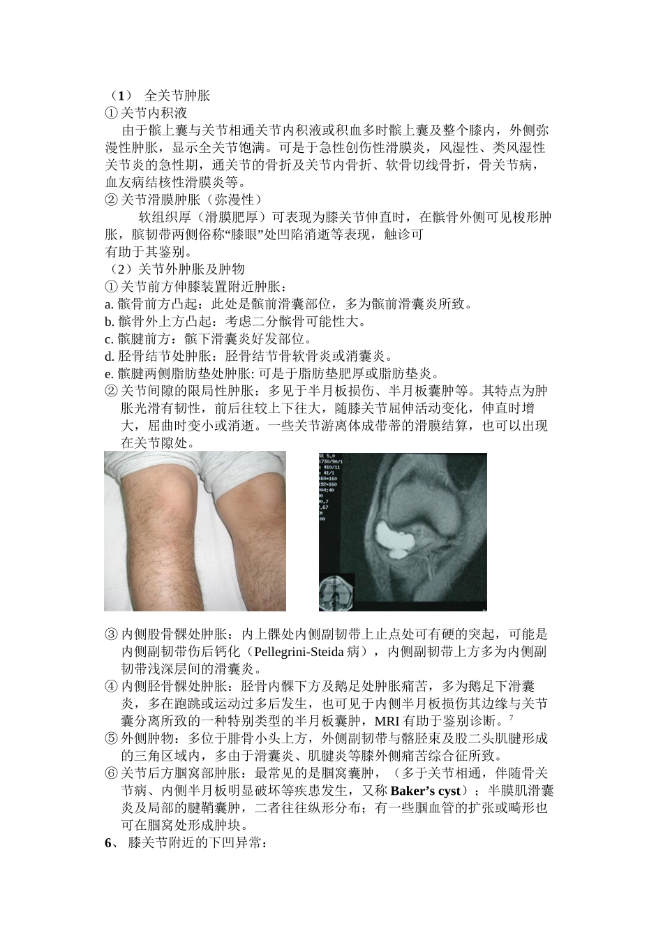 与膝关节镜手术相关疾患的膝关节检查法_第3页