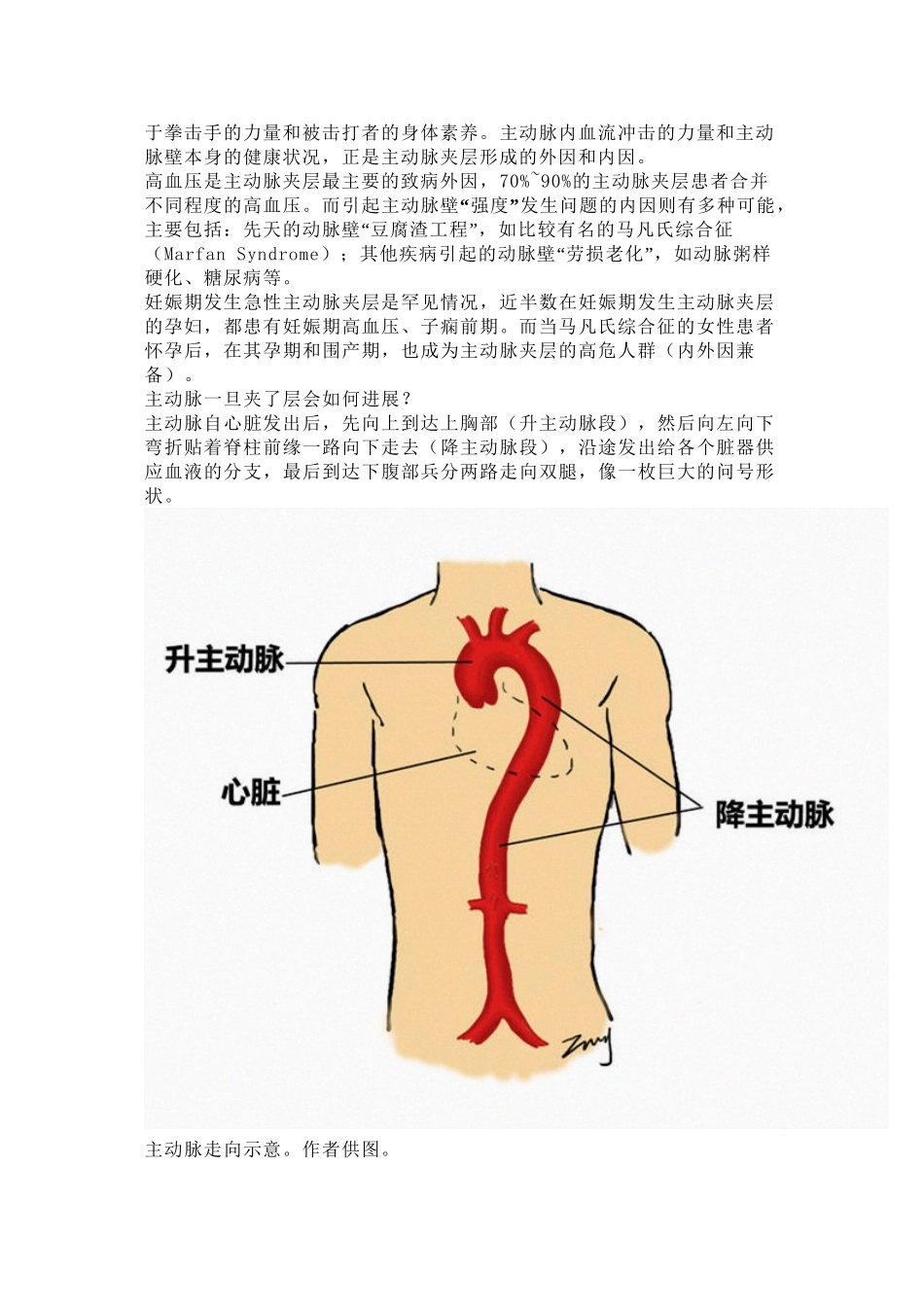 主动脉夹层是什么病？有多危险？_第2页