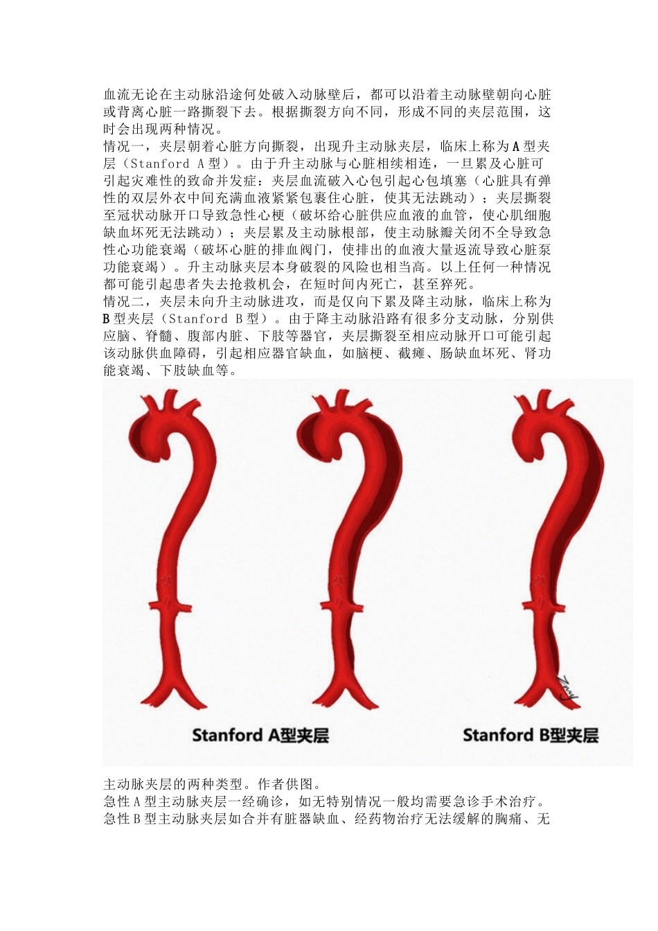 主动脉夹层是什么病？有多危险？_第3页