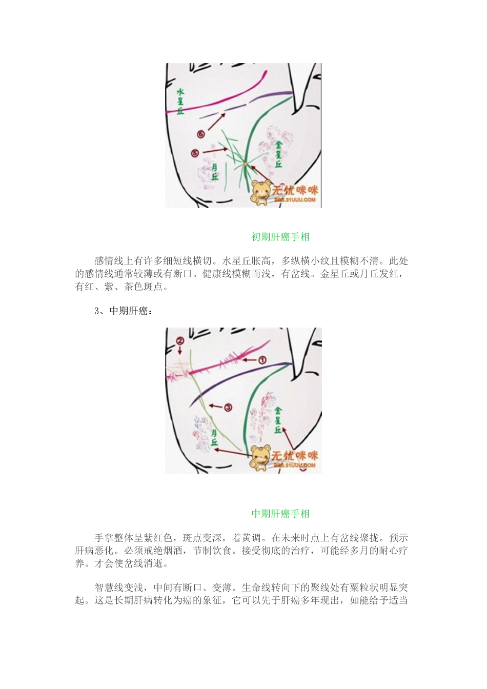 做自己的医生24种手相揭示身心健康问题_第2页