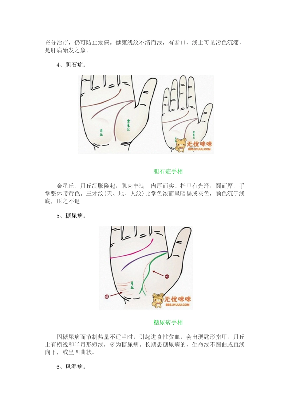 做自己的医生24种手相揭示身心健康问题_第3页