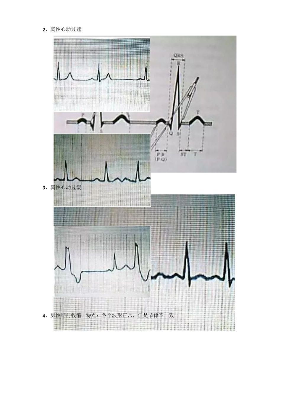 执业医师-内部学员面授资料——心电图_第2页