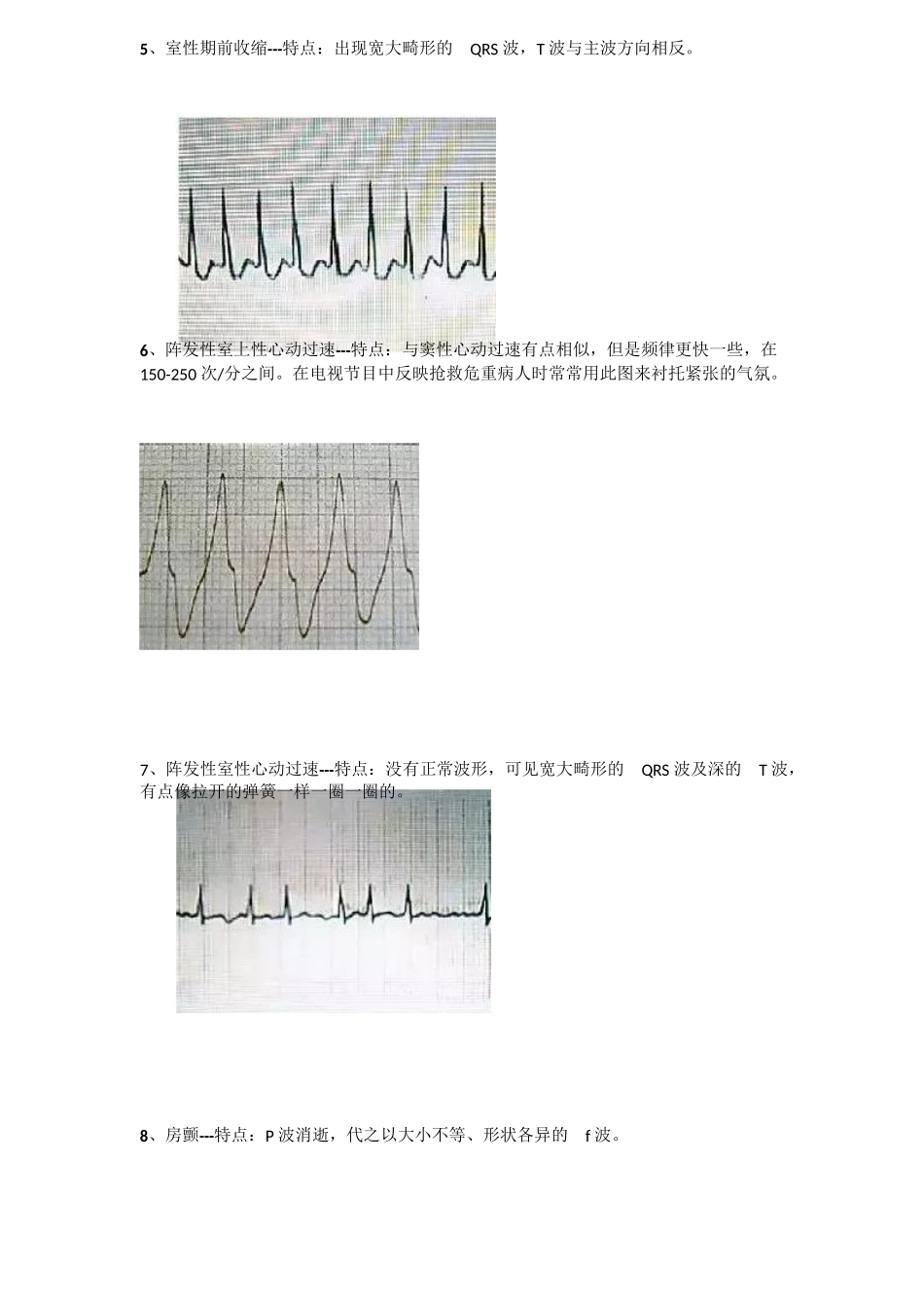 执业医师-内部学员面授资料——心电图_第3页