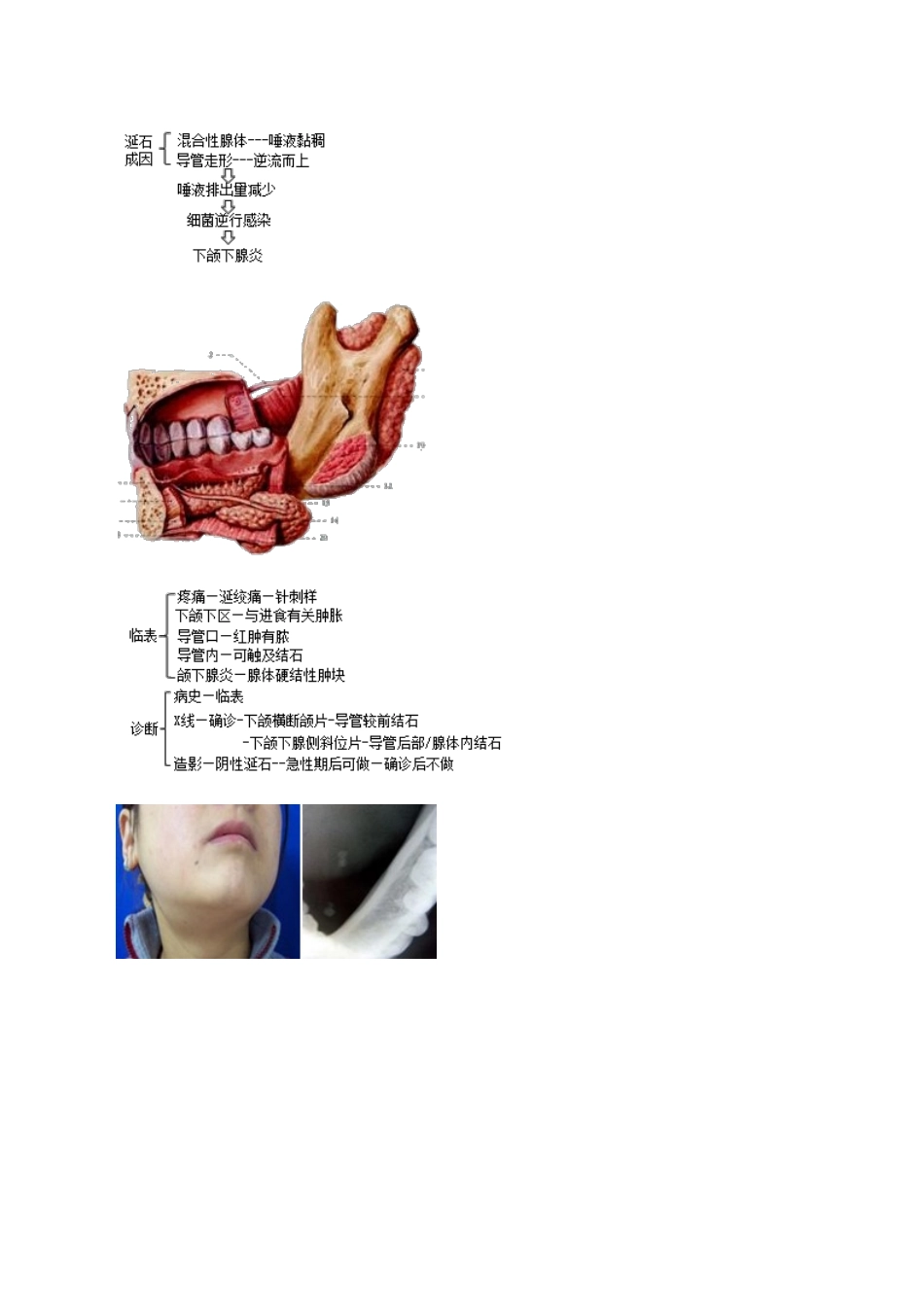 执业医师-口腔唾液腺疾病_第3页