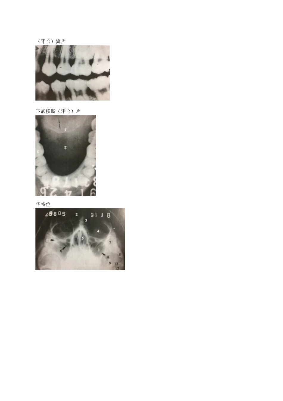 执业医师-口腔颌面部影像学诊断_第2页