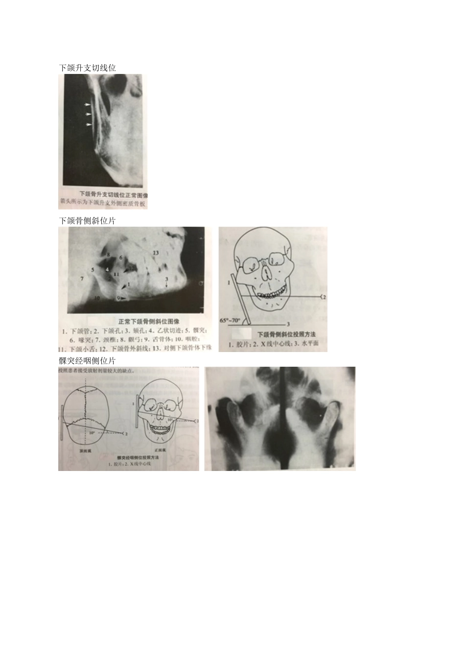 执业医师-口腔颌面部影像学诊断_第3页