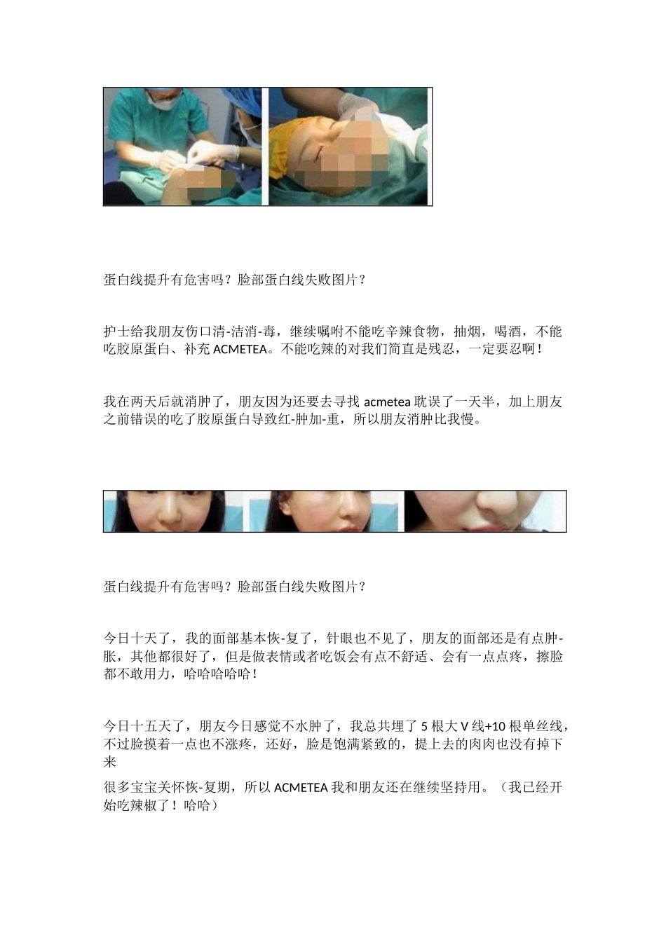 蛋白线提升有危害吗？脸部蛋白线失败图片？_第2页