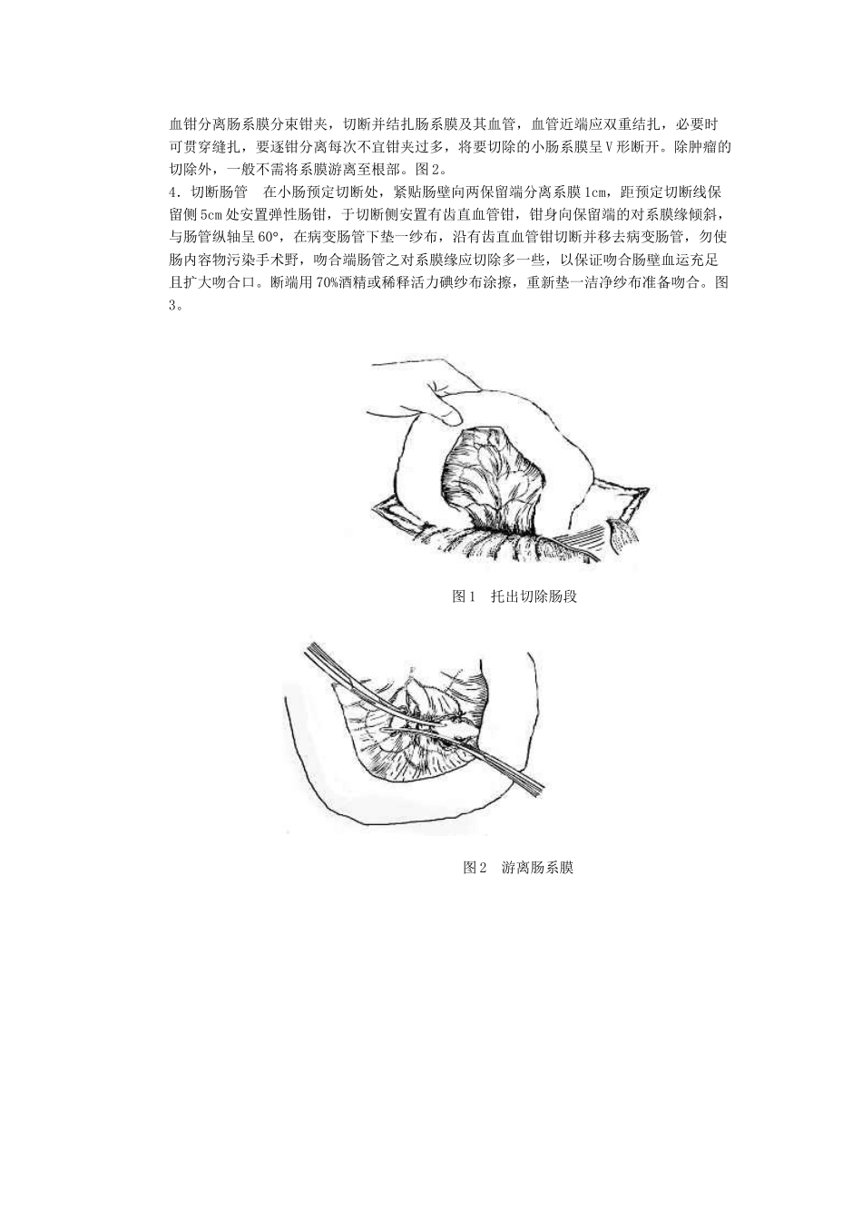 第九章小肠部分切除吻合术_第2页