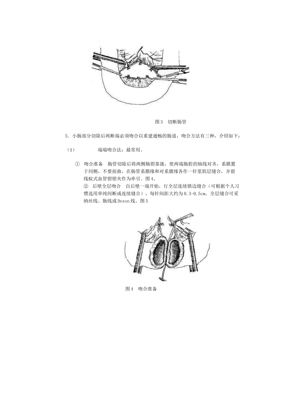 第九章小肠部分切除吻合术_第3页